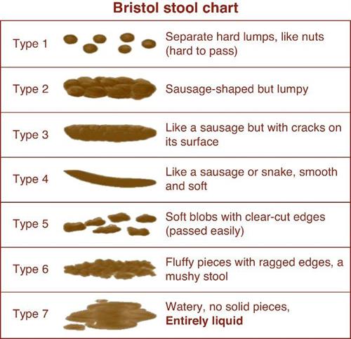 Gallery Image Bristol_Stool_Chart.jpg
