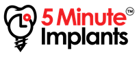 5 MINUTE IMPLANTS