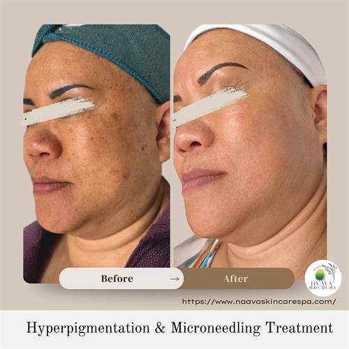 Gallery Image _Before_After_Pic_Instagram_Post.jpg