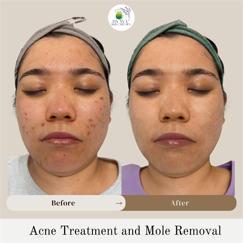 Gallery Image _Before_After_Pic_Instagram_Post.png