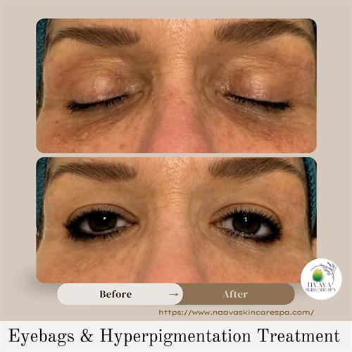 Gallery Image _Before_After_Pic_Instagram_Post_(1).jpg