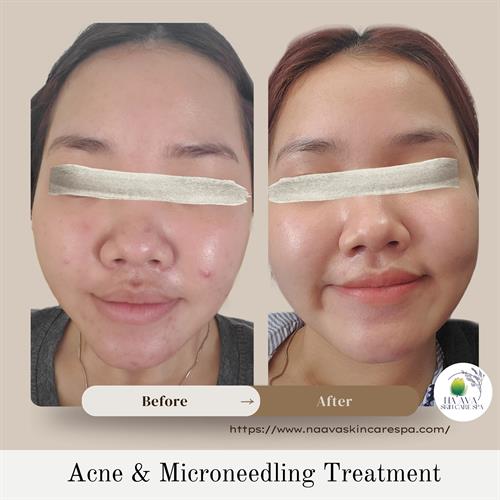 Gallery Image _Before_After_Pic_Instagram_Post_copy.jpg