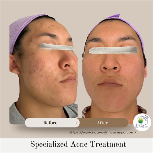 Gallery Image _Before_After_Pic_Instagram_Post_copy_3.jpg