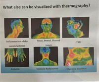 Thermography