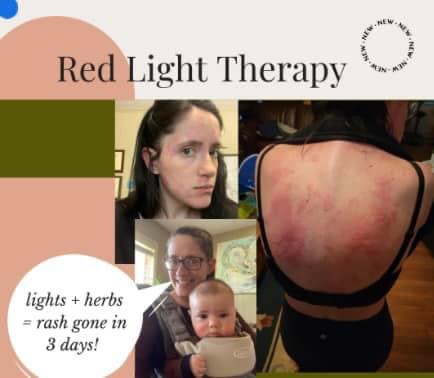 In Light Therapy Testimony