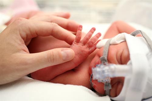 NICU infant receiving Pasteurized Donor Human Milk