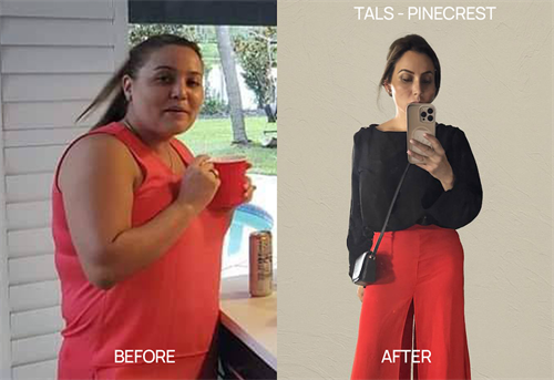 Medical Weight Loss Before / After