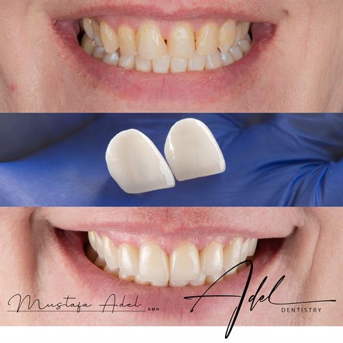 Gallery Image Untitle55d-2.jpg Gallery Image Untitle55d-2.jpg