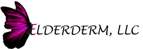 TODO