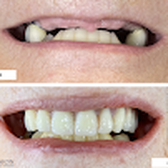 Gallery Image Precision%20Image%202.png