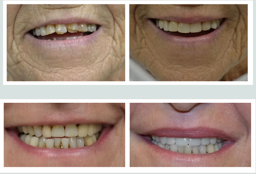 Gallery Image Screenshot%202026-03-10%20091912.png