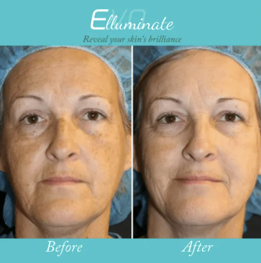 Gallery Image Screenshot%202026-04-01%20122320.png