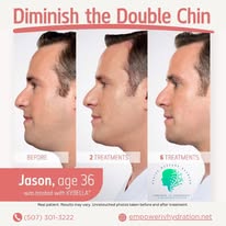 Gallery Image Double%20Chin.jpg