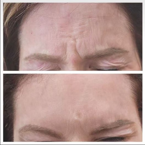 Gallery Image laser%20pic%201.JPG