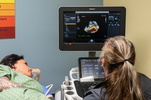 Gallery Image Cardiac_ultrasound_EPH_2025_1.jpg