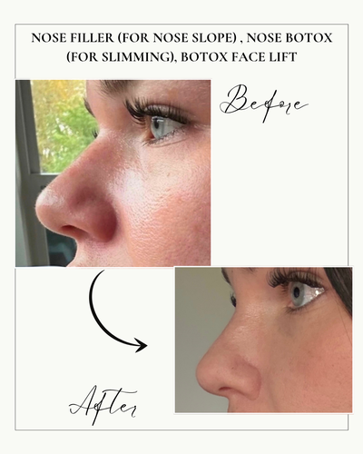 Gallery Image Cv%201.PNG