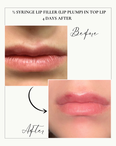 Gallery Image Cv5.PNG